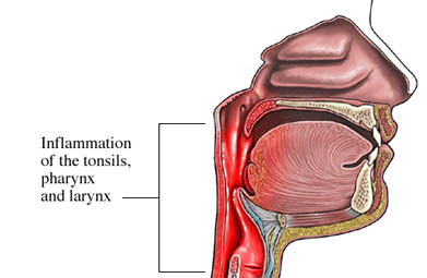 anatomy of common cold
